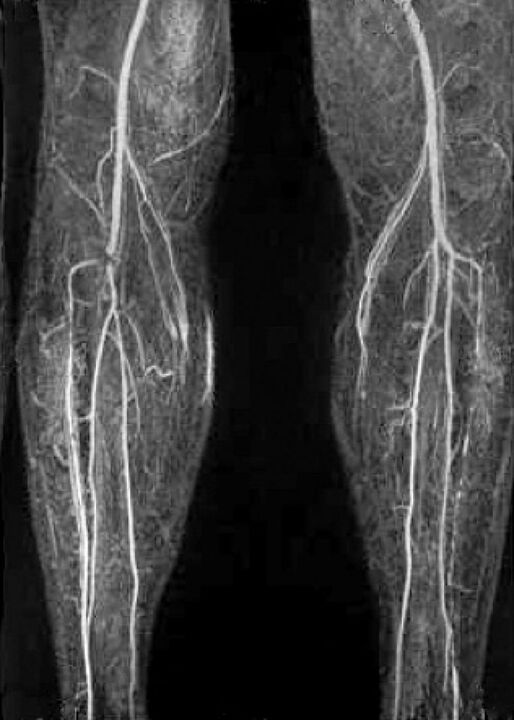 Navire x -ray