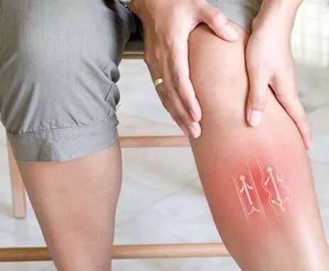 Trouble fonctionnel de la circulation sanguine veineuse dans la liaison inférieure