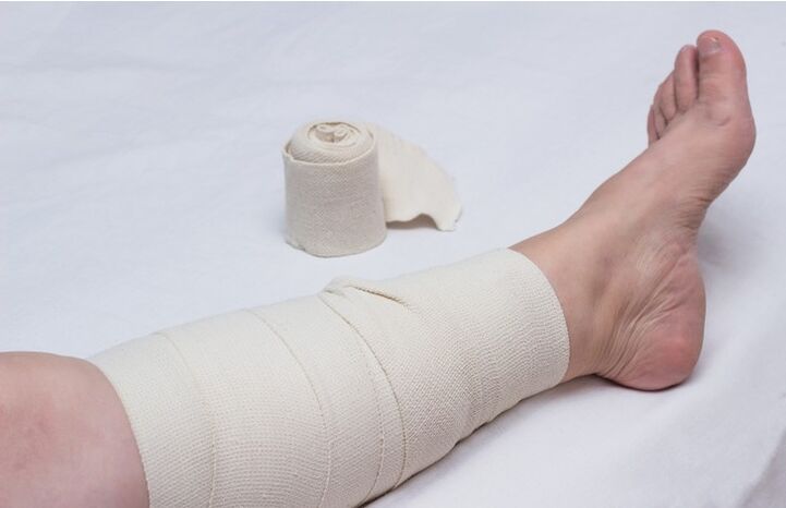 Bandage de compression sur la jambe pour les varices